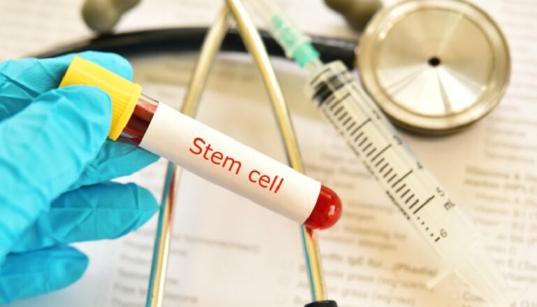 Addressing Common Concerns About Stem Cell Therapy